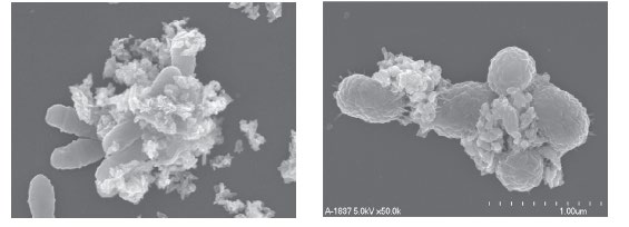 Adsorption schädlicher  Bakterien